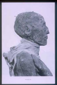 Mummy of Rameses III: head (side view).